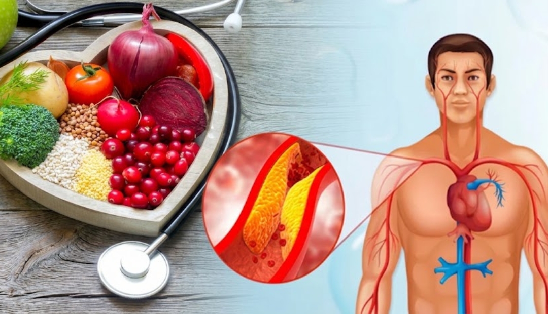 What Makes Cholesterol High When You Already Eat a Healthy Diet?