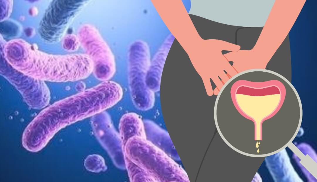 probiotics for women's urinary health
