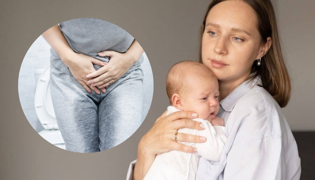 urine leakage after childbirth