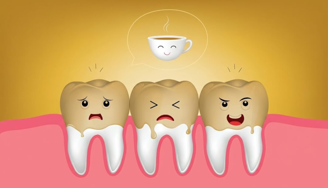 yellow teeth