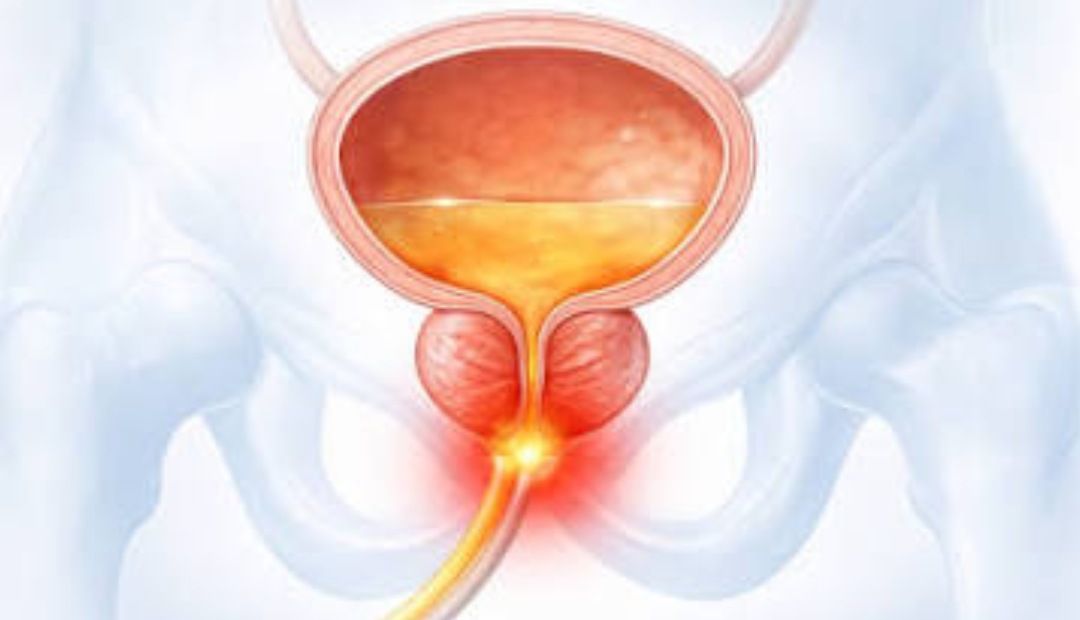 enlarged prostate and treatment