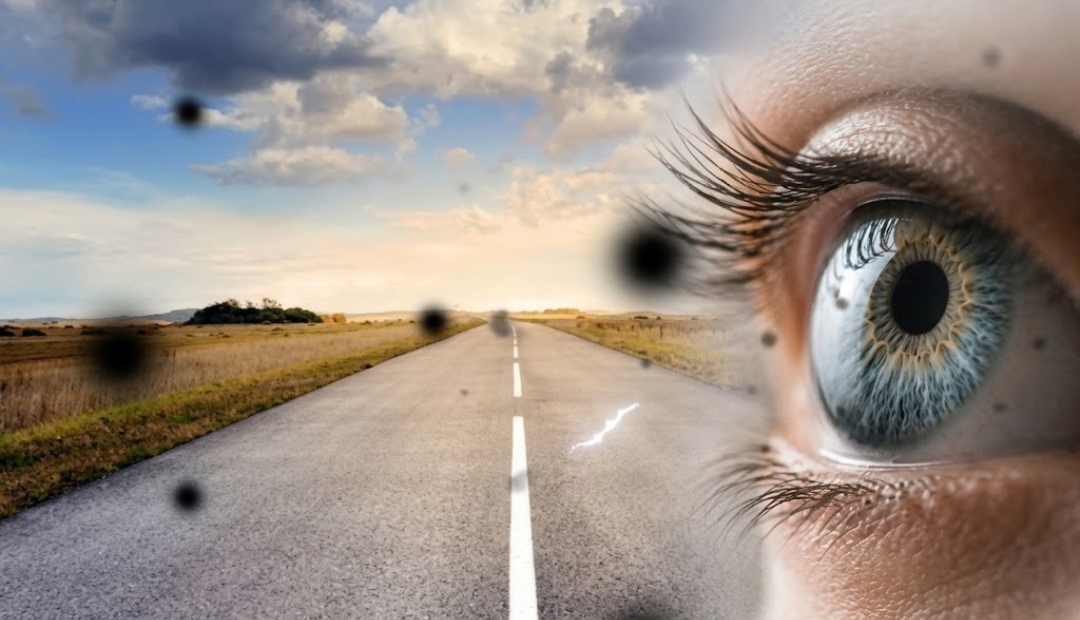 black spots in vision